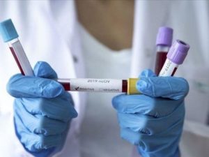 Azərbaycanda 143 nəfər koronavirusdan sağaldı, bir nəfər vəfat etdi – RƏSMİ