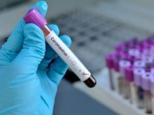 Baş infeksionist: “Səhlənkarlıq davam etsə, bizi Avropanın taleyi gözləyə bilər” – MÜSAHİBƏ