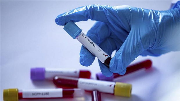 Süni koronavirus yaradıldı Süni koronavirus yaradıldı